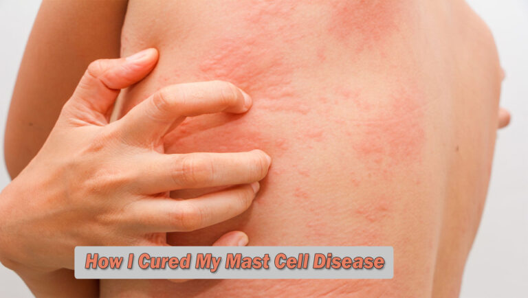 How I Cured My Mast Cell Disease