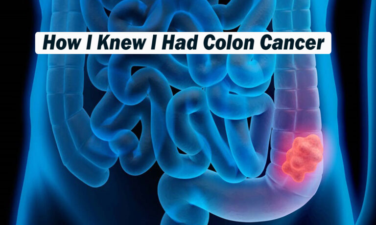 How I Knew I Had Colon Cancer