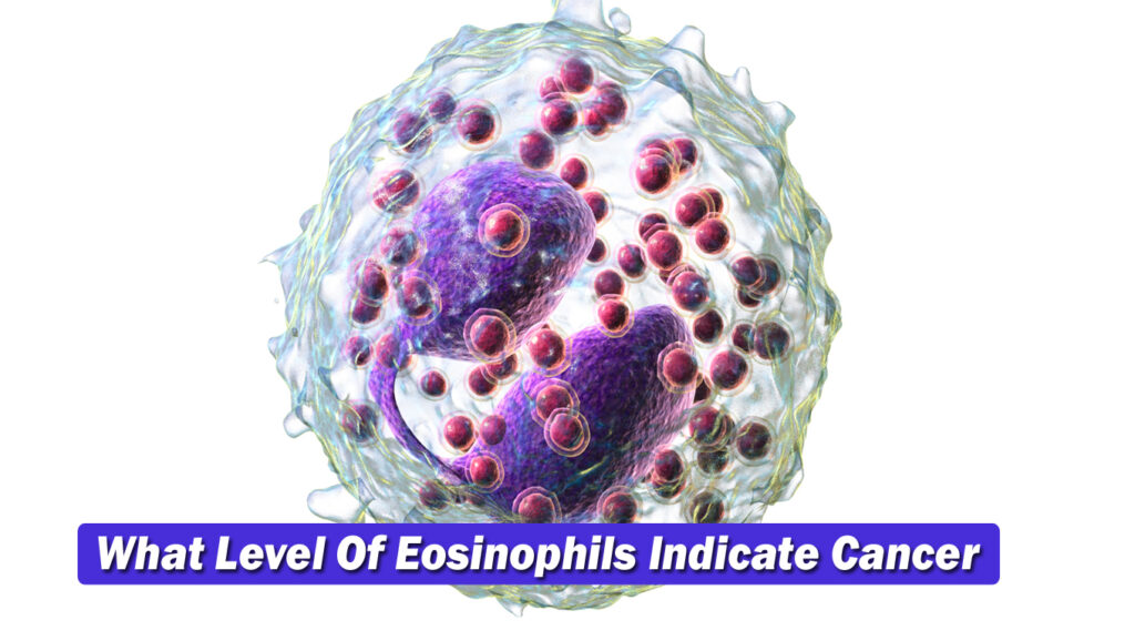 What Level Of Eosinophils Indicate Cancer