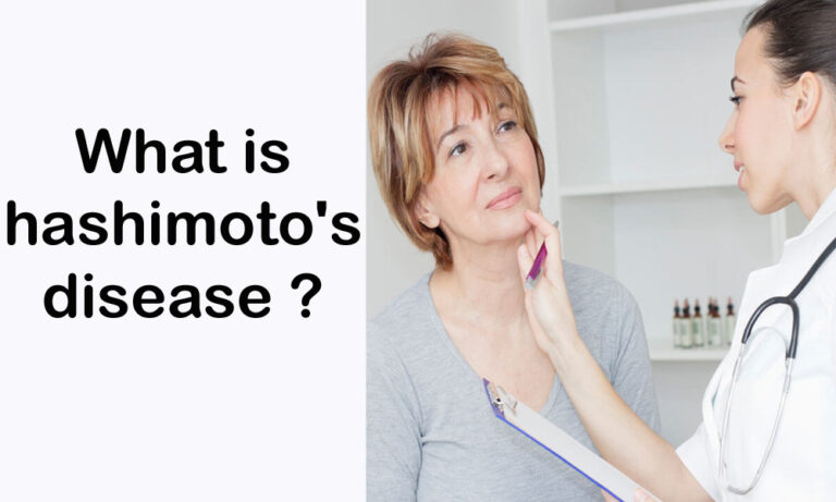 What is hashimoto's disease